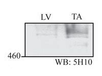 Anti-Obscurin Antibody, clone 5H10A | MABT126