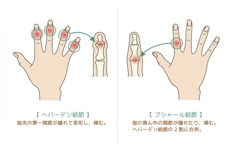 Image result for Volume Mass Problem