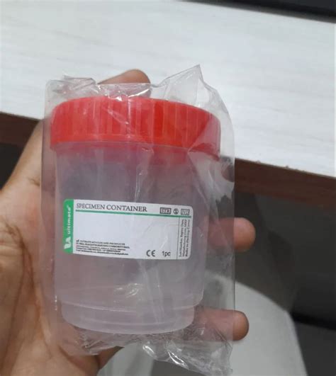 Urine & Stool Container - 100 ML Sterile Urine Container Trader ...