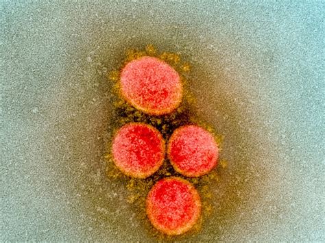 Coronavirus Under A Microscope
