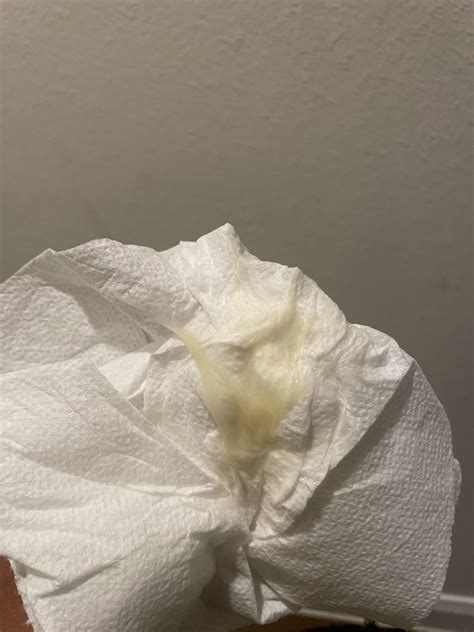 Normal Vaginal Discharge 的图像结果