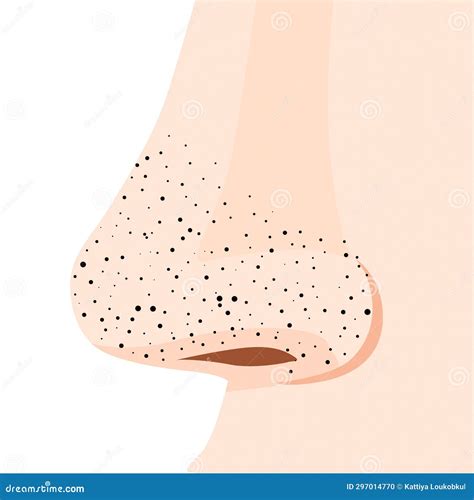 Nose Side With Blackheads Or Black Dots Or Acne Pimples, Illustration Close-up On White ...