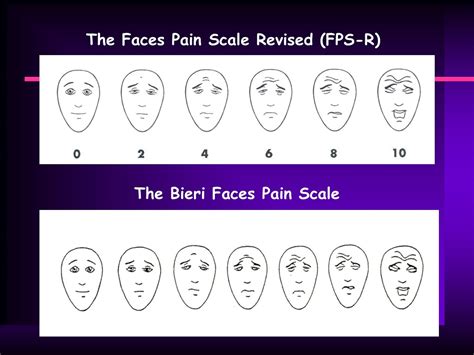 PPT - What is Pain? PowerPoint Presentation, free download - ID:9181694