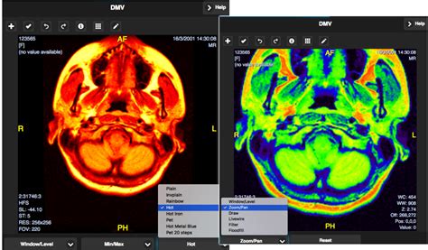 Dicom Viewer - App on Amazon Appstore