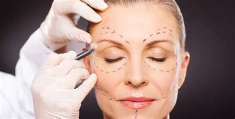 Skin Tightening Treats Loose and Sagging Skin on the Face: DNCC