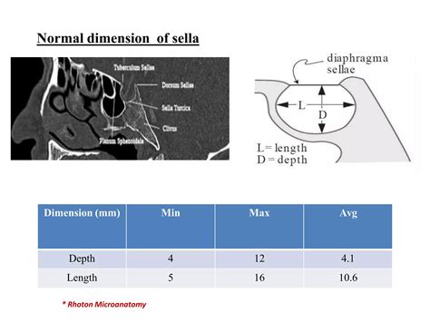 Empty sella syndrome | PPTX