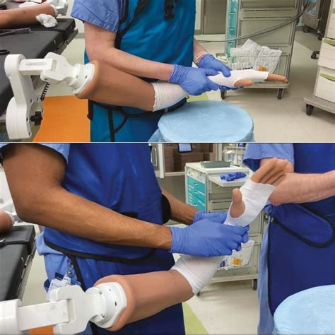 View of High-Fidelity Simulation Training for Closed Reduction and Casting of Distal Radius ...