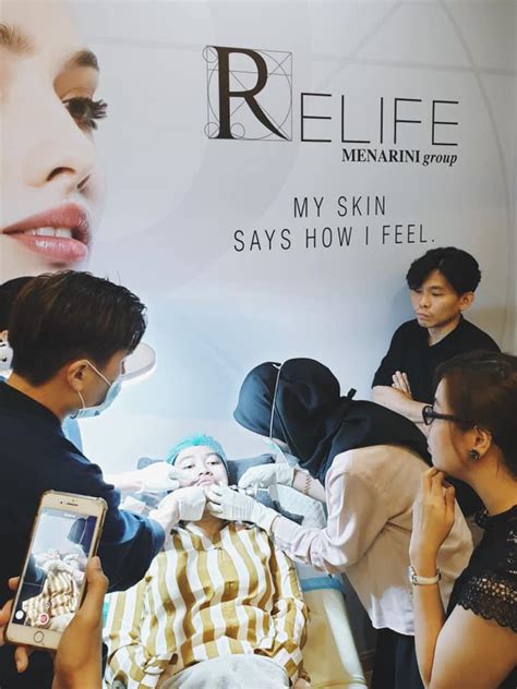 Image result for Thread Lift