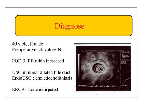 Image result for MATLAB Pinhole Camera Model