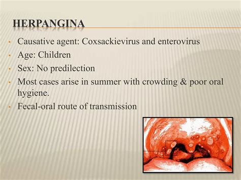 Viral infections (oral cavity) | PPTX