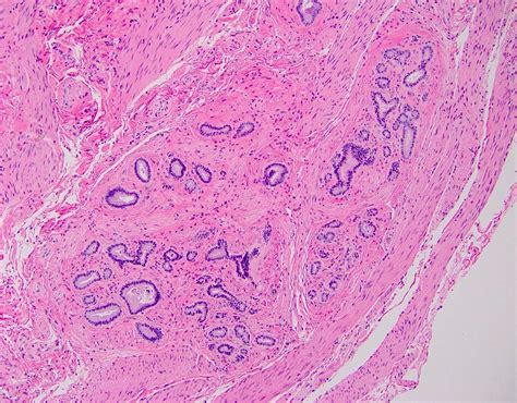 Papillary Duct Histology
