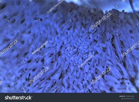 Bacteria Reproducing Under a Microscope 的图像结果