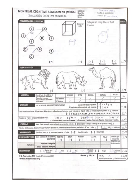 Montreal Cognitive Assessment (Moca) | PDF