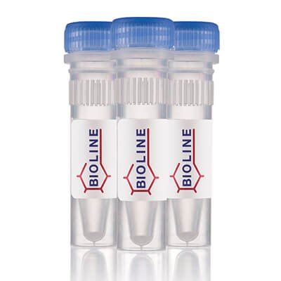 HyperLadder 1 kb 200 Lanes, DNA ladders, DNA India | Ubuy