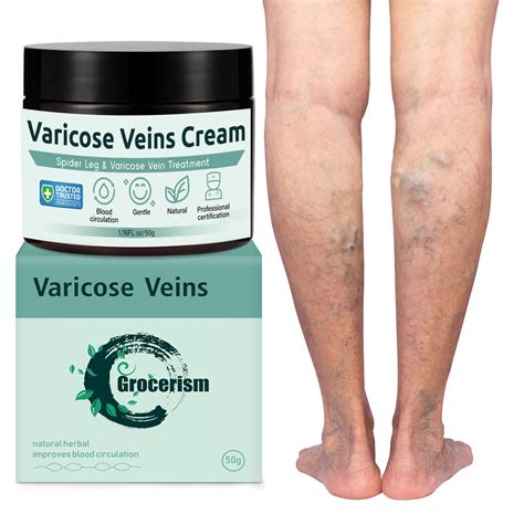 Spider Veins On Legs Treatment