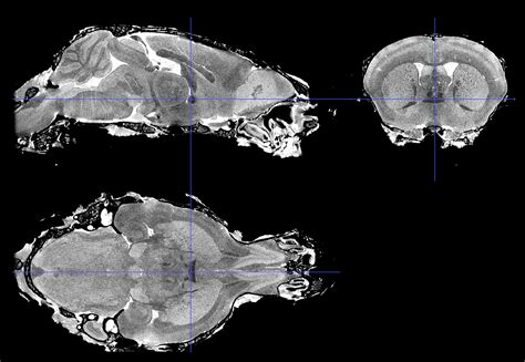 Scalable Brain Atlas - Allen Mouse Brain Common Coordinate Framework ...