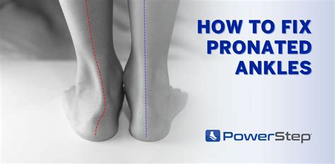 Overpronation Treatment Orthotics For Pronation And Overpronation