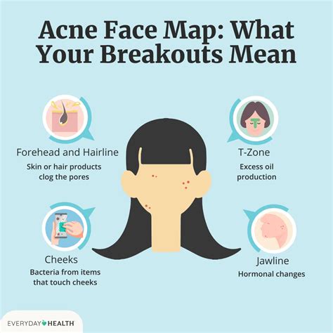 Acne Face Map: What These Breakouts Mean