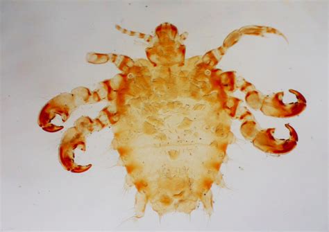 Pubic Crab Louse by R. Suter Microscope Slide | #1898232031