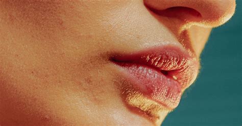 What To Do For Sunburned Lips: How To Prevent & Treat