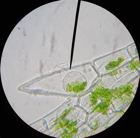 Elodea Under Microscope In Salt Water Cell Theory: 1. Every Organism
