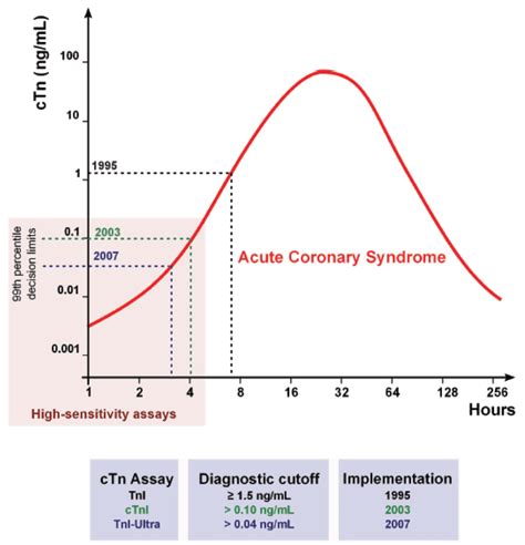 High Sensitivity Troponin Testing - REBEL EM - Emergency Medicine Blog