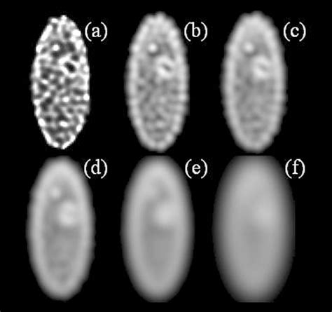 Image result for Iterative Reconstruction Osem