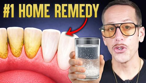 Why Yellow Teeth Are a Metabolic Warning Sign (And How to Whiten Naturally Without Damaging Your ...