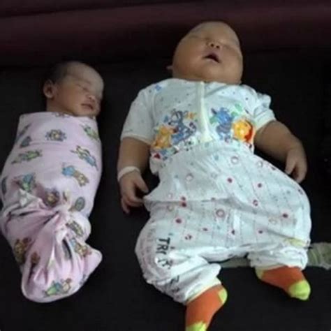 The Biggest Baby In The World Ever Born