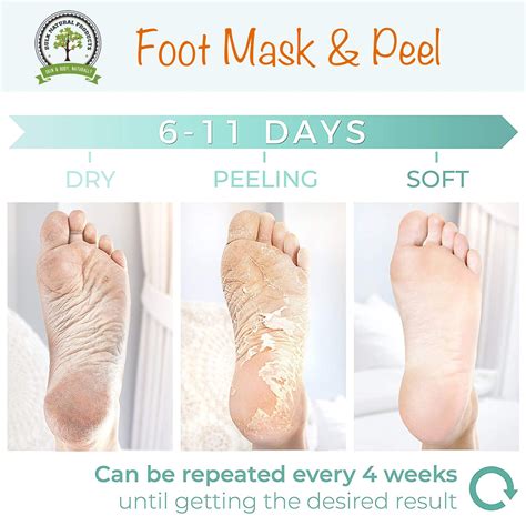 Baby Foot Peel Review: A Disgustingly Good Time Los Angeles Times ...