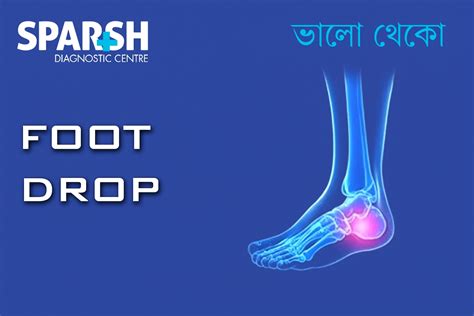 Hypoglycemic Encephalopathy: Causes, Symptoms, Diagnosis, Treatment & Prevention - Sparsh ...