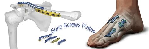 Bone Screws Plates Manufacturer, Orthopedic Implants, Ahmedabad