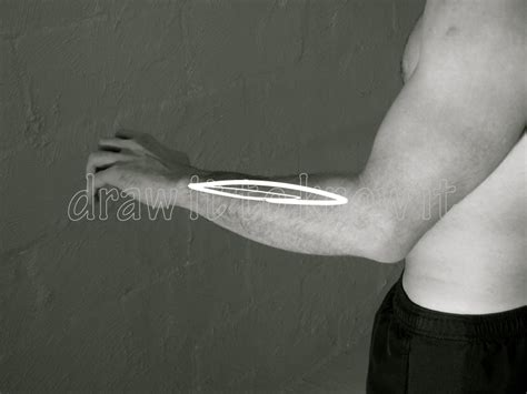 Image result for Extensor Digitorum Communis Surgery