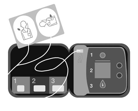 AEDのケースを開けているイラスト※中身のみ🎨【フリー素材】｜看護roo![カンゴルー]