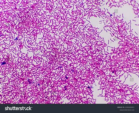 E Coli Gram Stain