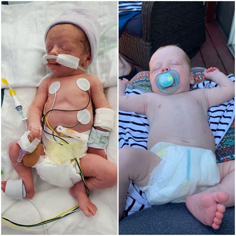 Top 103+ Pictures Baby Born At 29 Weeks Pictures Updated