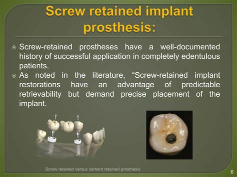Screw retained vs cement retained prosthesis.pptx