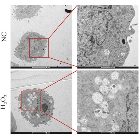 H2O2 Apoptosis 的图像结果