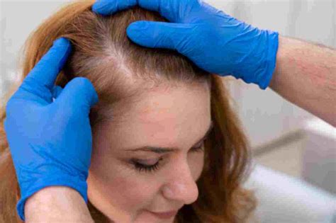 The Ultimate Guide to Understanding Hair Fall Causes