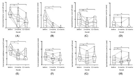Comparison of Motor Scores between OFF and ON States in Tremor-Dominant ...