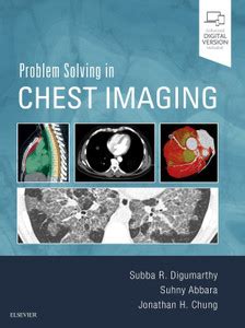 Problem Solving in Chest Imaging: Buy Problem Solving in Chest Imaging ...