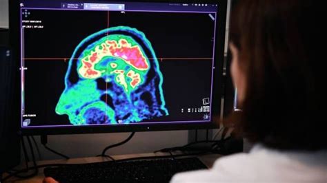 Can brain tumour be detected using urine test?