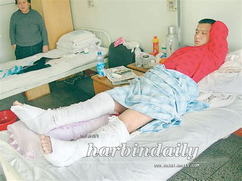 右腿骨折送医院 左腿箍上石膏(组图)-搜狐新闻