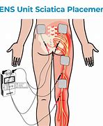 Image result for Tens Unit for Sciatica Pain