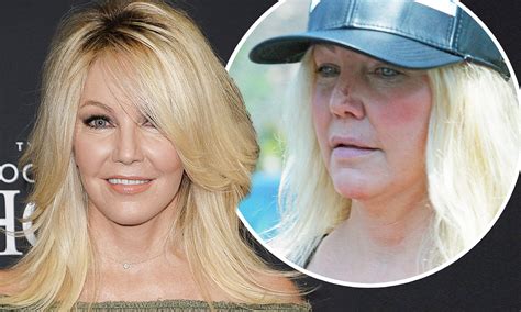 Heather Locklear Face Surgery