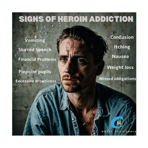 What Is The Timeline For Heroin Withdrawal And How Do You Treat It?