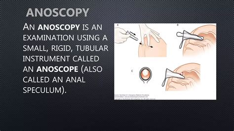 Digital rectal examination.pptx @ | PPTX