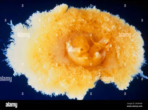 Embryo. A six week old embryo seen together with the chorion. The ...