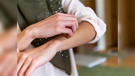 Coronavirus Symptoms: 5 signs of skin infection in COVID-19