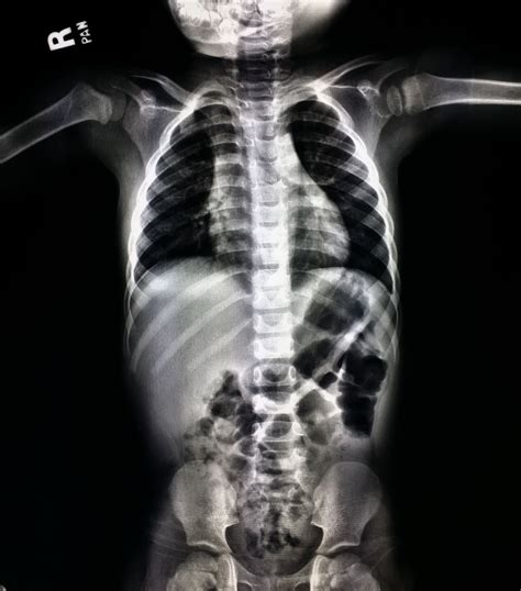 baby x ray machine - Alia Barbosa